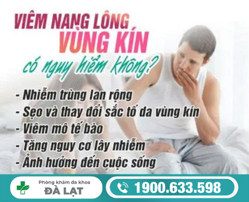 Hình ảnh minh họa